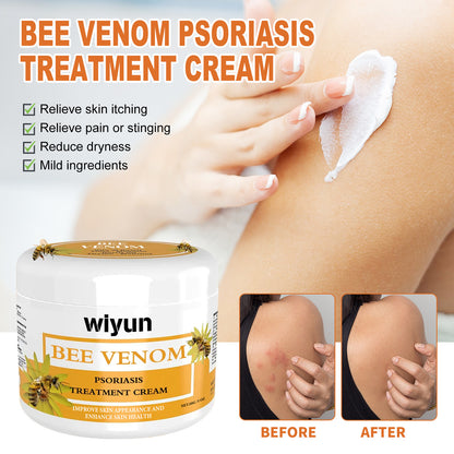 WIYUN Bee Venom Psoriasis Cream Repairs red and itchy skin on hands and feet, moisturizes and smoothes skin care cream 